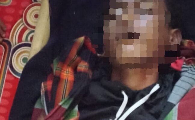 Di Bayongbong Garut Ada Remaja Tersambar Petir