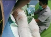 Usai Mendapatkan Perawatan Intensif, Korban Kebakaran Akhirnya Meninggal Dunia